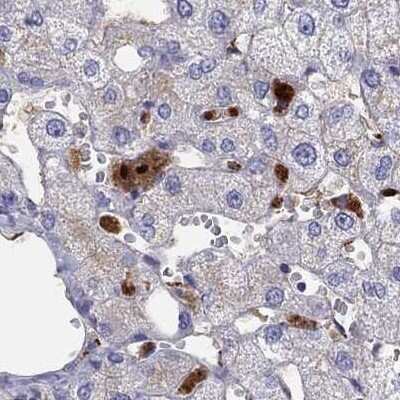 Immunohistochemistry-Paraffin: Serpin A3/alpha 1-Antichymotrypsin Antibody [NBP1-90295] - Staining of human liver.