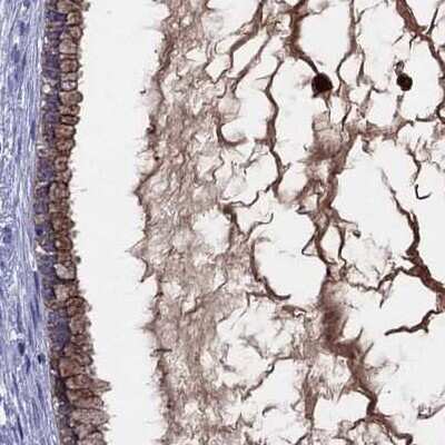 Immunohistochemistry-Paraffin: Serpin A3/alpha 1-Antichymotrypsin Antibody [NBP1-90295] - Staining of human cervix, uterine.