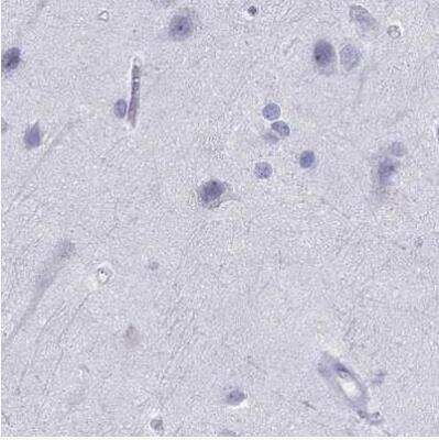 Immunohistochemistry-Paraffin: Serpin A3/alpha 1-Antichymotrypsin Antibody [NBP1-90296] - Staining of human cerebral cortex using Anti-SERPINA3 antibody.