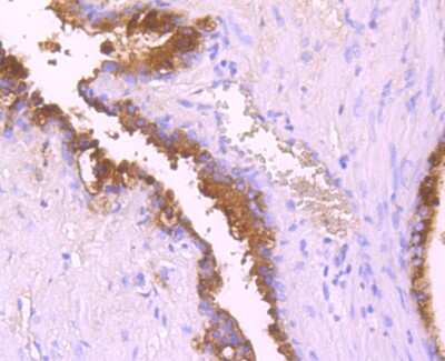 Immunohistochemistry-Paraffin: Serpin A3/alpha 1-Antichymotrypsin Antibody (JM83-29) [NBP2-67138] - Immunohistochemical analysis of paraffin-embedded human prostate tissue using anti-Serpin A3/alpha 1-Antichymotrypsin antibody. Counter stained with hematoxylin.
