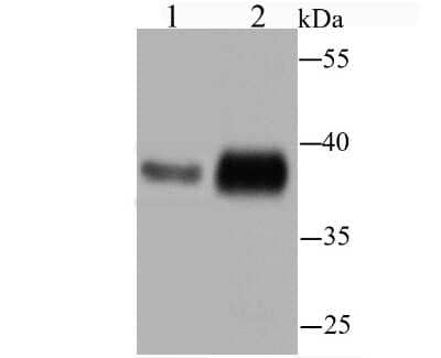 Western Blot: Serpin A3/alpha 1-Antichymotrypsin Antibody (JM83-29) [NBP2-67138] - Analysis of alpha 1 Antichymotrypsin on human serum using anti-alpha 1 Antichymotrypsin antibody at 1/1,000 dilution.