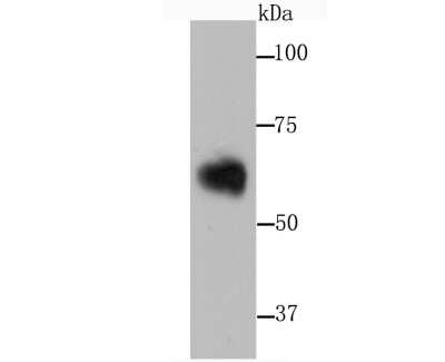 Western Blot: Serpin A3/alpha 1-Antichymotrypsin Antibody (JM83-29) [NBP2-67138] - Western blot analysis of Serpin A3/alpha 1-Antichymotrypsin on human serum using anti-Serpin A3/alpha 1-Antichymotrypsin antibody at 1/1,000 dilution.