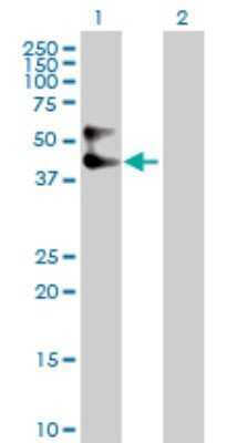 Western Blot: Serpin A3/alpha 1-Antichymotrypsin Antibody [H00000012-D01] - Analysis of SERPINA3 expression in transfected 293T cell line by SERPINA3 polyclonal antibody.Lane 1: SERPINA3 transfected lysate(47.70 KDa).Lane 2: Non-transfected lysate.