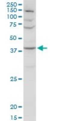 Western Blot: Serpin A3/alpha 1-Antichymotrypsin Antibody [H00000012-D01P] - Analysis of SERPINA3 expression in HeLa.