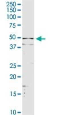 Western Blot: Serpin A3/alpha 1-Antichymotrypsin Antibody [H00000012-D01P] - Analysis of SERPINA3 expression in HepG2.
