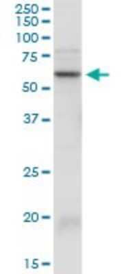 Western Blot: Serpin A3/alpha 1-Antichymotrypsin Antibody [H00000012-D01P] - Analysis of SERPINA3 expression in mouse brain.