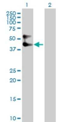 Western Blot: Serpin A3/alpha 1-Antichymotrypsin Antibody [H00000012-D01P] - Analysis of SERPINA3 expression in transfected 293T cell line by SERPINA3 polyclonal antibody.Lane 1: SERPINA3 transfected lysate(47.70 KDa).Lane 2: Non-transfected lysate.