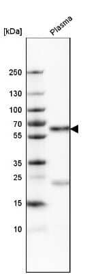 Western Blot: Serpin A3/alpha 1-Antichymotrypsin Antibody [NBP1-90295] - Analysis in human plasma.