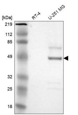 Western Blot: Serpin A3/alpha 1-Antichymotrypsin Antibody [NBP1-90296] - Analysis in human cell line RT-4 and human cell line U-251 MG.