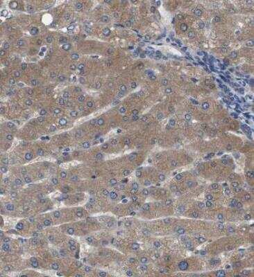 Immunohistochemistry-Paraffin: Serpin A6/Cortisol Binding Globulin Antibody [NBP1-88174] - Staining of human liver shows moderate cytoplasmic positivity in hepatocytes.