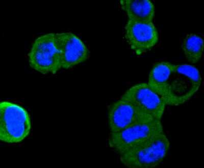 Immunocytochemistry/Immunofluorescence: Serpin A8/Angiotensinogen Antibody (SD201-02) [NBP2-67778] - Staining Angiotensinogen in LO2 cells (green). The nuclear counter stain is DAPI (blue). Cells were fixed in paraformaldehyde, permeabilised with 0.25% Triton X100/PBS.