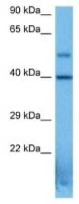 Western Blot: Serpin B1C Antibody [NBP3-10209] - Western blot analysis of Serpin B1C in Mouse Stomach lysates. Antibody dilution at 1ug/ml