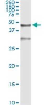 Immunoprecipitation: Serpin B3/SCCA1 Antibody (2F5) [H00006317-M01] - Analysis of SERPINB3 transfected lysate using anti-SERPINB3 monoclonal antibody and Protein A Magnetic Bead, and immunoblotted with SERPINB3 MaxPab rabbit polyclonal antibody.