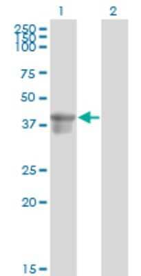 Western Blot: Serpin B3/SCCA1 Antibody (2F5) [H00006317-M01] - Analysis of SERPINB3 expression in transfected 293T cell line by SERPINB3 monoclonal antibody (M01), clone 2F5.Lane 1: SERPINB3 transfected lysate(44.6 KDa).Lane 2: Non-transfected lysate.