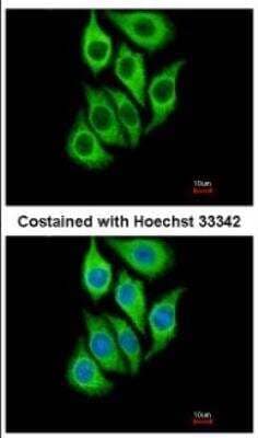 Immunocytochemistry/Immunofluorescence: Serpin B3/SCCA1 Antibody [NBP2-20310] - Analysis of methanol-fixed A549 1:500 dilution.