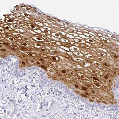 Immunohistochemistry: Serpin B3/SCCA1 Antibody [NBP2-46829] - Staining of human vagina shows strong cytoplasmic and nuclear positivity in squamous epithelial cells.