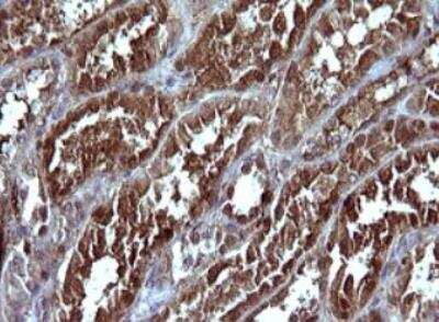 Immunohistochemistry-Paraffin: Serpin B3/SCCA1 Antibody (OTI1A12) - Azide and BSA Free [NBP2-74109] -  Staining of paraffin-embedded Human Kidney tissue within the normal limits using anti-SERPINB3 mouse monoclonal antibody. (Heat-induced epitope retrieval by 10mM citric buffer, pH6.0, 120 degrees C for 3min.