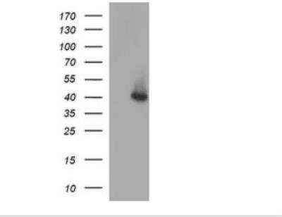 Western Blot: Serpin B3/SCCA1 Antibody (OTI1A12) - Azide and BSA Free [NBP2-74109] - HEK293T cells were transfected with the pCMV6-ENTRY control (Left lane) or pCMV6-ENTRY SERPINB3 (RC202683, Right lane) cDNA for 48 hrs and lysed. Equivalent amounts of cell lysates (5 ug per lane) were separated by SDS-PAGE and immunoblotted with anti-SERPINB3. Positive lysates LY416321 (100ug).