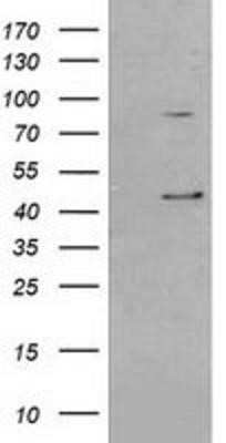 Western Blot: Serpin B3/SCCA1 Antibody (OTI3C2) [NBP2-03483] - HEK293T cells were transfected with the pCMV6-ENTRY control (Left lane) or pCMV6-ENTRY SerpinB3 (Right lane) cDNA for 48 hrs and lysed. Equivalent amounts of cell lysates (5 ug per lane) were separated by SDS-PAGE and immunoblotted with anti-SerpinB3.