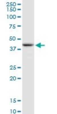 Western Blot: Serpin B3/SCCA1 Antibody [H00006317-B01P] - Analysis of SERPINB3 expression in Hela S3 NE.