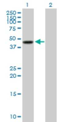 Western Blot: Serpin B3/SCCA1 Antibody [H00006317-D03P] - Analysis of SERPINB3 expression in transfected 293T cell line by SERPINB3 polyclonal antibody.Lane 1: SERPINB3 transfected lysate(42.90 KDa).Lane 2: Non-transfected lysate.