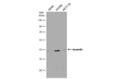 Western Blot: Serpin B3/SCCA1 Antibody [NBP2-20310] - Various whole cell extracts (30 ug) were separated by 10% SDS-PAGE, and the membrane was blotted with Serpin B3 antibody diluted at 1:3000. HRP-conjugated anti-rabbit IgG antibody was used to detect the primary antibody.