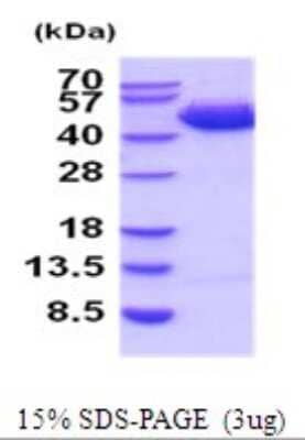 SDS-Page: Recombinant Human Serpin B3/SCCA1 Protein [NBP2-52095] - 15% SDS Page (3 ug)