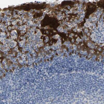 Immunohistochemistry-Paraffin: Serpin B5/Maspin Antibody [NBP1-87780] - Staining of human tonsil shows strong cytoplasmic positivity in squamous epithelial cells.