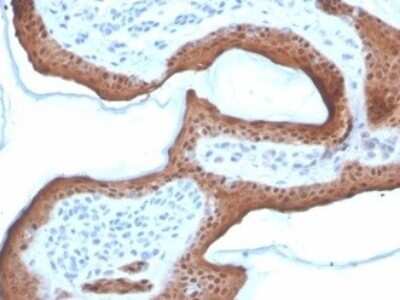 Immunohistochemistry-Paraffin: Serpin B5/Maspin Antibody (SERPINB5/4972) [NBP3-13732] - Formalin-fixed, paraffin-embedded human skin stained with Serpin B5/Maspin antibody (SERPINB5/4972). HIER: Tris/EDTA, pH9.0, 45min. HRP-polymer, 30min. DAB, 5min