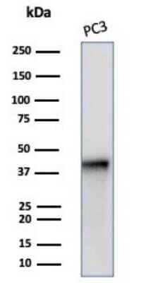 Western Blot: Serpin B5/Maspin Antibody (SERPINB5/4972) [NBP3-13732] - Western blot analysis of PC3 cell lysate using Serpin B5/Maspin antibody (SERPINB5/4972).