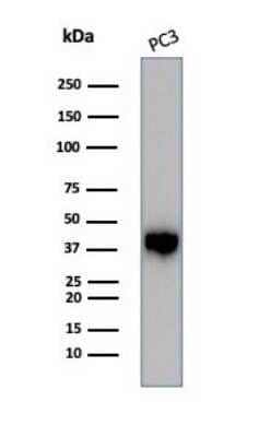 Western Blot: Serpin B5/Maspin Antibody (SERPINB5/4975) [NBP3-13733] - Western blot analysis of PC3 cell lysate using Serpin B5/Maspin antibody (SERPINB5/4975).