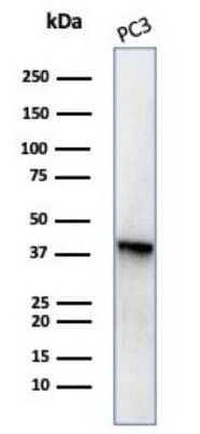 Western Blot: Serpin B5/Maspin Antibody (SERPINB5/4977) [NBP3-13734] - Western blot analysis of PC3 cell lysate using Serpin B5/Maspin antibody (SERPINB5/4977).