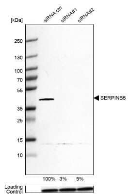 <b>Genetic Strategies Validation. </b>Western Blot: Serpin B5/Maspin Antibody [NBP1-87780] - Analysis in HeLa cells transfected with control siRNA, target specific siRNA probe #1 and #2,. Remaining relative intensity is presented. Loading control: Anti-PPIB.