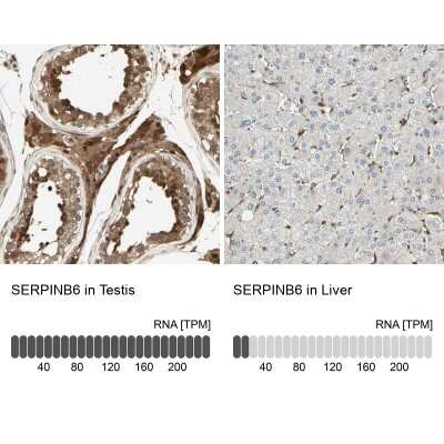 Immunohistochemistry-Paraffin: Serpin B6 Antibody [NBP1-86642] - Staining in human testis and liver tissues using anti-SERPINB6 antibody. Corresponding SERPINB6 RNA-seq data are presented for the same tissues.