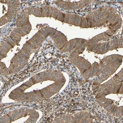 Immunohistochemistry-Paraffin: Serpin B6 Antibody [NBP1-86643] - Staining of human endometrium shows moderate cytoplasmic positivity in glandular cells.