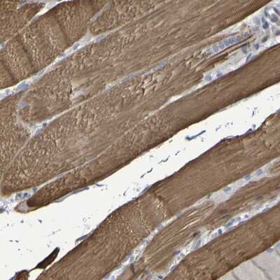 Immunohistochemistry-Paraffin: Serpin B6 Antibody [NBP1-86643] - Staining of human skeletal muscle shows positivity in myocytes.