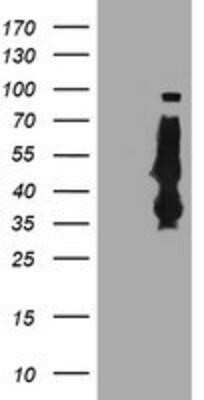 Western Blot: Serpin B6 Antibody (OTI1C5) - Azide and BSA Free [NBP2-74111] - HEK293T cells were transfected with the pCMV6-ENTRY control (Left lane) or pCMV6-ENTRY SerpinB6 (Right lane) cDNA for 48 hrs and lysed. Equivalent amounts of cell lysates (5 ug per lane) were separated by SDS-PAGE and immunoblotted with anti-SerpinB6.