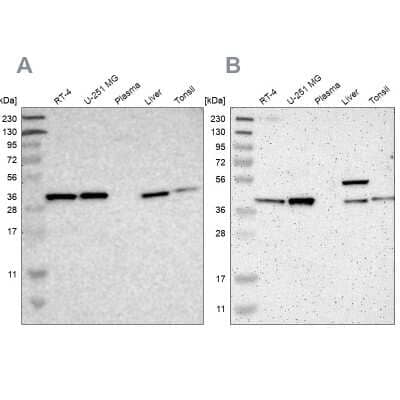 <b>Independent Antibodies Validation and Orthogonal Strategies Validation.</b>Western Blot: Serpin B6 Antibody [NBP1-86642] - Analysis using Anti-SERPINB6 antibody NBP1-86642 (A) shows similar pattern to independent antibody NBP1-86643 (B).