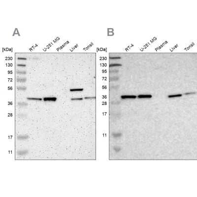 Western Blot: Serpin B6 Antibody [NBP1-86643] - Analysis using Anti-SERPINB6 antibody NBP1-86643 (A) shows similar pattern to independent antibody NBP1-86642 (B).