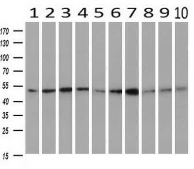 Western Blot: Serpin C1/Antithrombin-III Antibody (OTI8D5) - Azide and BSA Free [NBP2-74113] - Analysis of extracts (10ug) from 10 Human tissue by using anti-SERPINC1 monoclonal antibody at 1:500 (1: Testis; 2: Omentum; 3: Uterus; 4: Breast; 5: Brain; 6: Liver; 7: Ovary; 8: Thyroid gland; 9: colon;10: spleen).