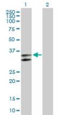 Western Blot: Serpin C1/Antithrombin-III Antibody [H00000462-B01P] - analysis of SERPINC1 expression in transfected 293T cell line by SERPINC1 MaxPab polyclonal antibody. Lane 1: SERPINC1 transfected lysate (28.49 KDa). Lane 2: Non-transfected lysate.