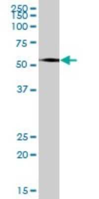Western Blot: Serpin C1/Antithrombin-III Antibody [H00000462-B01P] - Analysis of SERPINC1 expression in human kidney.