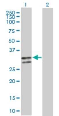 Western Blot: Serpin C1/Antithrombin-III Antibody [H00000462-D01P] - Analysis of SERPINC1 expression in transfected 293T cell line by SERPINC1 polyclonal antibody.Lane 1: SERPINC1 transfected lysate(29.10 KDa).Lane 2: Non-transfected lysate.