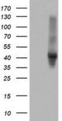 Western Blot: Serpin E2/PN1 Antibody (2C9) [NBP2-01984] - HEK293T cells were transfected with the pCMV6-ENTRY control (Left lane) or pCMV6-ENTRY SERPINE2 (Right lane) cDNA for 48 hrs and lysed. Equivalent amounts of cell lysates (5 ug per lane) were separated by SDS-PAGE and immunoblotted with anti-SERPINE2.