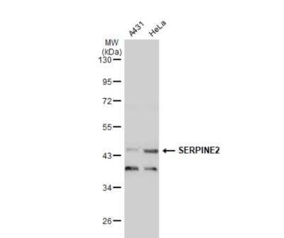 Western Blot: Serpin E2/PN1 Antibody [NBP2-20315] - Various whole cell extracts (30 ug) were separated by 10% SDS-PAGE, and the membrane was blotted with SERPINE2 antibody diluted at 1:2000. The HRP-conjugated anti-rabbit IgG antibody (NBP2-19301) was used to detect the primary antibody.