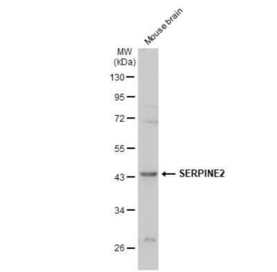 Western Blot: Serpin E2/PN1 Antibody [NBP2-20315] - Mouse tissue extract (50 ug) was separated by 10% SDS-PAGE, and the membrane was blotted with SERPINE2 antibody diluted at 1:2000. The HRP-conjugated anti-rabbit IgG antibody (NBP2-19301) was used to detect the primary antibody.