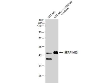 Western Blot: Serpin E2/PN1 Antibody [NBP2-20315] - U87-MG whole cell extract and conditioned medium (30 ug) were separated by 10% SDS-PAGE, and the membrane was blotted with SERPINE2 antibody diluted at 1:2000. The HRP-conjugated anti-rabbit IgG antibody (NBP2-19301) was used to detect the primary antibody.