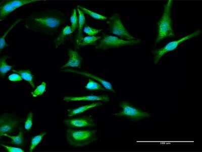 Immunocytochemistry/Immunofluorescence: Serpin F2/alpha 2-Antiplasmin Antibody [H00005345-D01P] - Analysis of antibody to SERPINF2 on HeLa cell. Antibody concentration 30 ug/ml.