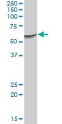 Western Blot: Serpin F2/alpha 2-Antiplasmin Antibody [H00005345-B01P] - Analysis of SERPINF2 expression in human stomach.