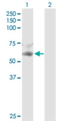 Western Blot: Serpin F2/alpha 2-Antiplasmin Antibody [H00005345-D01P] - Analysis of SERPINF2 expression in transfected 293T cell line by SERPINF2 polyclonal antibody.Lane 1: SERPINF2 transfected lysate(54.60 KDa).Lane 2: Non-transfected lysate.
